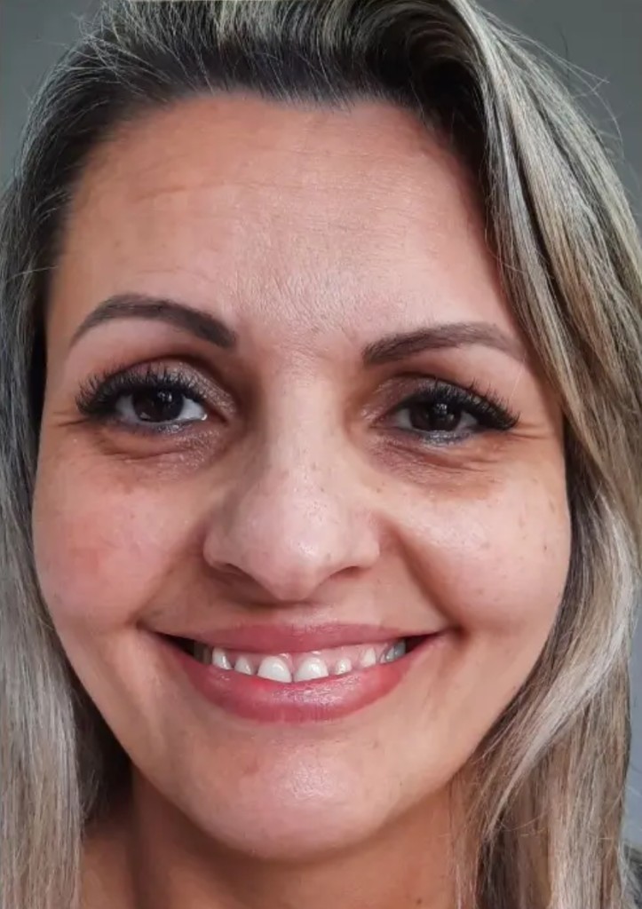 Antes do tratamento